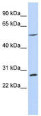 BTB Domain Containing 2 antibody, TA335536, Origene, Western Blot image 