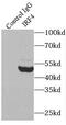 Interferon regulatory factor 4 antibody, FNab04390, FineTest, Immunoprecipitation image 