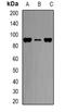 Carnitine Palmitoyltransferase 1A antibody, orb340887, Biorbyt, Western Blot image 