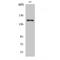 Ankyrin Repeat Domain 30A antibody, LS-C382024, Lifespan Biosciences, Western Blot image 
