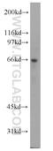 Arginyltransferase 1 antibody, 13973-1-AP, Proteintech Group, Western Blot image 