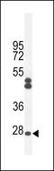 Chromosome 6 Open Reading Frame 62 antibody, LS-C168693, Lifespan Biosciences, Western Blot image 
