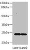 Melanocortin 2 Receptor Accessory Protein 2 antibody, CSB-PA853421LA01HU, Cusabio, Western Blot image 