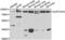 SPT20 Homolog, SAGA Complex Component antibody, LS-C349299, Lifespan Biosciences, Western Blot image 