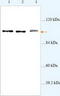 Eukaryotic Translation Initiation Factor 4E Nuclear Import Factor 1 antibody, TA310050, Origene, Western Blot image 