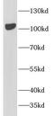 Protein Tyrosine Kinase 2 antibody, FNab10444, FineTest, Western Blot image 