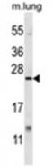 X-Box Binding Protein 1 antibody, AP54580PU-N, Origene, Western Blot image 