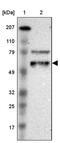 Embryonal Fyn-Associated Substrate antibody, PA5-51602, Invitrogen Antibodies, Western Blot image 