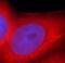Keratin 7 antibody, FNab02219, FineTest, Immunofluorescence image 