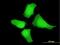 Mitogen-Activated Protein Kinase Kinase 5 antibody, H00005607-M07, Novus Biologicals, Immunofluorescence image 