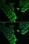 Hyaluronan Binding Protein 2 antibody, PA5-77064, Invitrogen Antibodies, Immunofluorescence image 