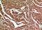 C-Type Lectin Domain Containing 6A antibody, A11863-1, Boster Biological Technology, Immunohistochemistry frozen image 