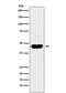 CD134 antibody, M02495, Boster Biological Technology, Western Blot image 