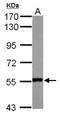 SET And MYND Domain Containing 1 antibody, NBP2-20428, Novus Biologicals, Western Blot image 