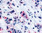 Cysteinyl Leukotriene Receptor 1 antibody, TA340418, Origene, Immunohistochemistry frozen image 
