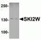 Ski2 Like RNA Helicase antibody, NBP2-81903, Novus Biologicals, Western Blot image 