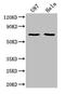 Sushi Domain Containing 5 antibody, CSB-PA022971LA01HU, Cusabio, Western Blot image 