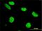 Zinc Finger Protein 207 antibody, H00007756-M02, Novus Biologicals, Immunocytochemistry image 