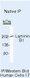 Laminin subunit beta-1 antibody, MA5-14657, Invitrogen Antibodies, Immunoprecipitation image 