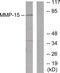 Matrix Metallopeptidase 15 antibody, LS-C118522, Lifespan Biosciences, Western Blot image 