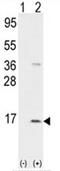 Platelet basic protein antibody, AP17656PU-N, Origene, Western Blot image 