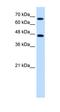 Nuclear Receptor Subfamily 4 Group A Member 2 antibody, orb329685, Biorbyt, Western Blot image 