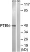 Phosphatidylinositol-3,4,5-trisphosphate 3-phosphatase and dual-specificity protein phosphatase PTEN antibody, TA313352, Origene, Western Blot image 