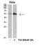 Hepatocyte Nuclear Factor 4 Alpha antibody, STJ98691, St John