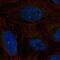 ERCC Excision Repair 6, Chromatin Remodeling Factor antibody, NBP2-68917, Novus Biologicals, Immunofluorescence image 