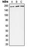 Complement C4A (Rodgers Blood Group) antibody, MBS821727, MyBioSource, Western Blot image 