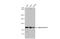 Actinin Alpha 2 antibody, GTX103219, GeneTex, Western Blot image 