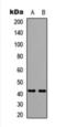 Free Fatty Acid Receptor 4 antibody, orb393124, Biorbyt, Western Blot image 