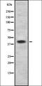 Solute Carrier Family 27 Member 1 antibody, orb336775, Biorbyt, Western Blot image 