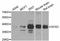 Quiescin Sulfhydryl Oxidase 1 antibody, A11501, ABclonal Technology, Western Blot image 