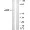 Autoimmune Regulator antibody, A00558, Boster Biological Technology, Western Blot image 
