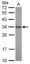 Phenylethanolamine N-Methyltransferase antibody, NBP2-19877, Novus Biologicals, Western Blot image 