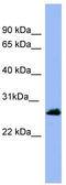 RAB5A, Member RAS Oncogene Family antibody, TA342212, Origene, Western Blot image 
