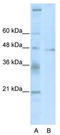 Tumor Susceptibility 101 antibody, TA343598, Origene, Western Blot image 