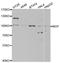 Major Vault Protein antibody, A1980, ABclonal Technology, Western Blot image 