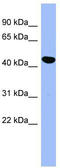 Serpin Family E Member 2 antibody, TA345150, Origene, Western Blot image 