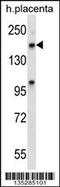 Exportin-5 antibody, 58-228, ProSci, Western Blot image 