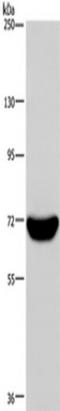Lymphocyte Cytosolic Protein 1 antibody, TA350140, Origene, Western Blot image 