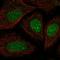 Synaptonemal Complex Central Element Protein 2 antibody, HPA062919, Atlas Antibodies, Immunofluorescence image 