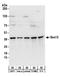 SEC13 Homolog, Nuclear Pore And COPII Coat Complex Component antibody, A303-980A, Bethyl Labs, Western Blot image 