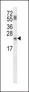 Phosphopantothenoylcysteine Decarboxylase antibody, 57-391, ProSci, Western Blot image 