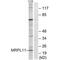 Mitochondrial Ribosomal Protein L11 antibody, PA5-49937, Invitrogen Antibodies, Western Blot image 