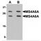 Membrane Spanning 4-Domains A6A antibody, MBS151373, MyBioSource, Western Blot image 