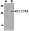 C-Type Lectin Domain Containing 7A antibody, orb75791, Biorbyt, Western Blot image 