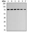 Aspartyl-tRNA synthetase, mitochondrial antibody, orb341364, Biorbyt, Western Blot image 