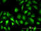 Phosphoglucomutase 1 antibody, LS-C197889, Lifespan Biosciences, Immunofluorescence image 